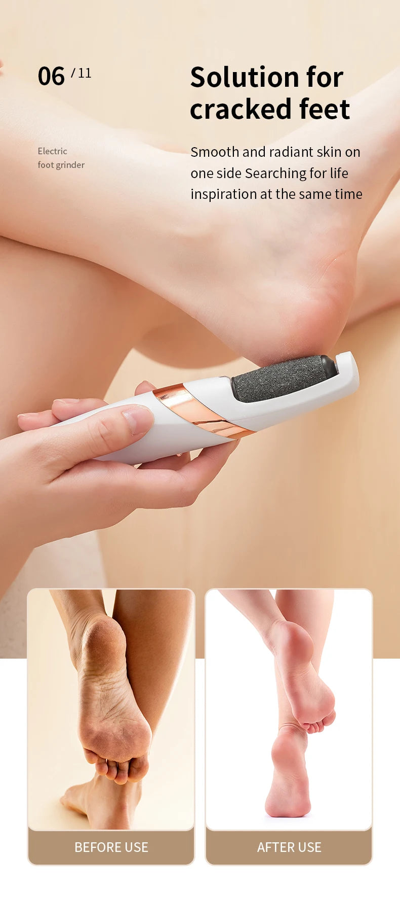 Electric Foot Grinder – Callus Remover & Heel Smoother for Soft Cracked Feet