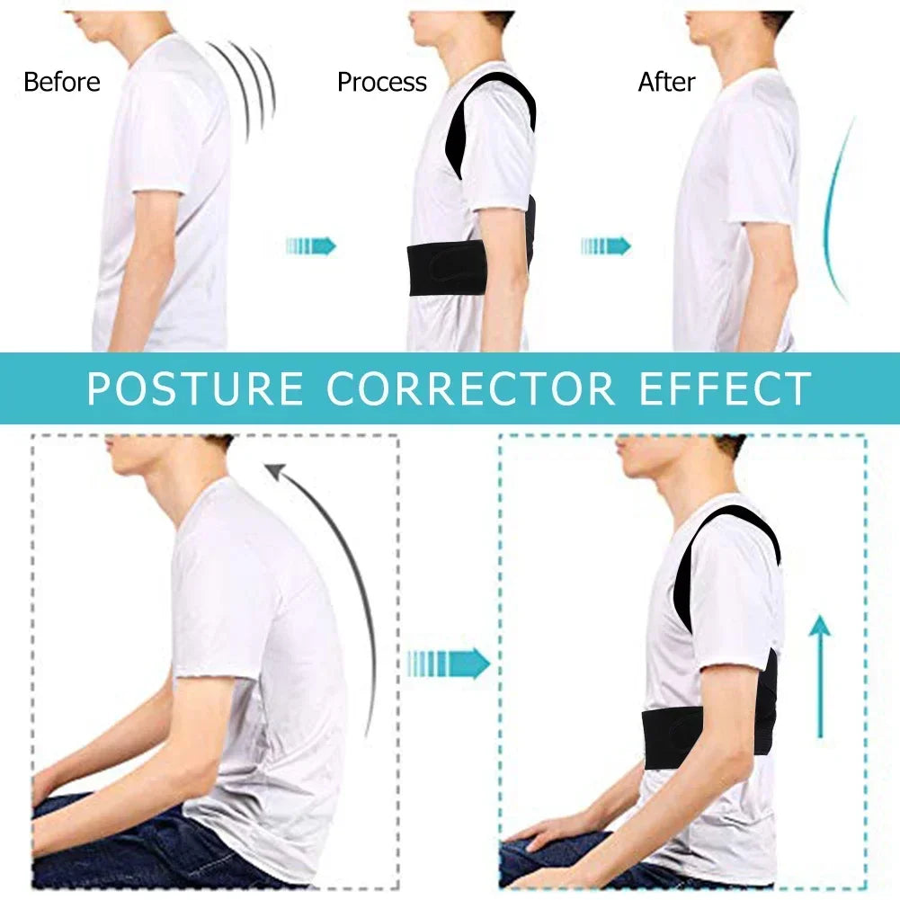 Posture Corrector – Adjustable Back Support Brace for Men & Women
