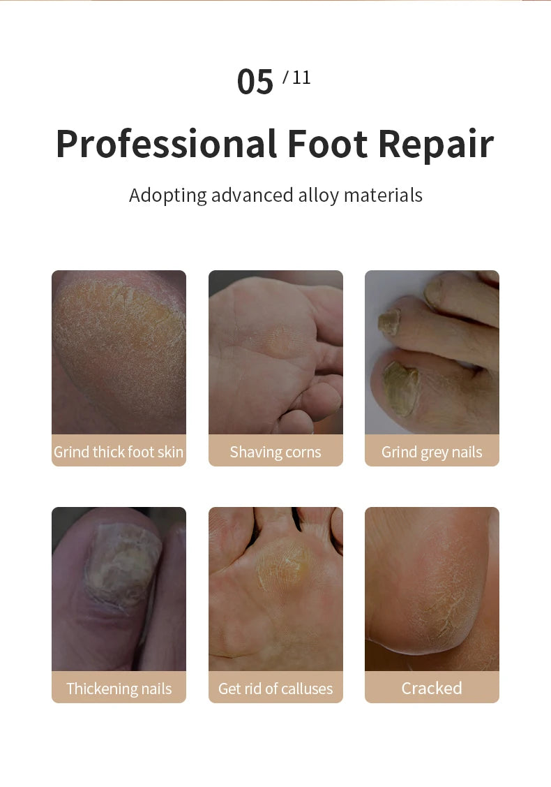 Electric Foot Grinder – Callus Remover & Heel Smoother for Soft Cracked Feet